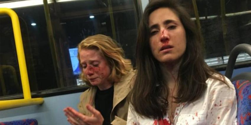 Foto van mishandelde vrouwen Foto van mishandelde vrouwen