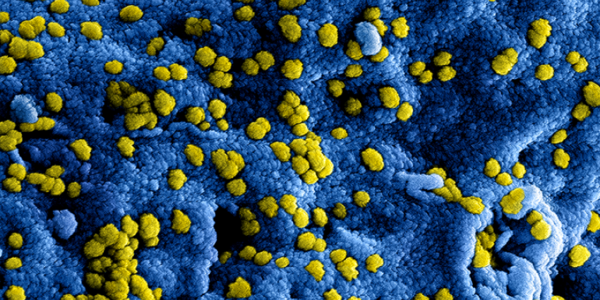 Coronavirus Coronavirus