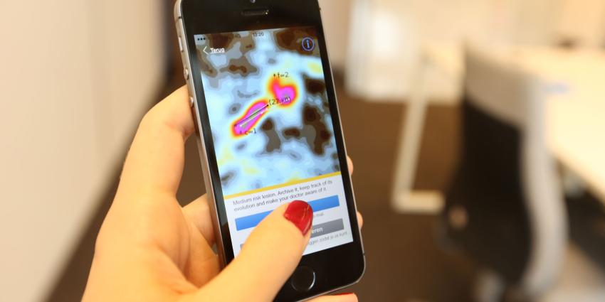 Gratis advies dermatoloog op Huidkankerdag via zelf-check app Gratis advies dermatoloog op Huidkankerdag via zelf-check app