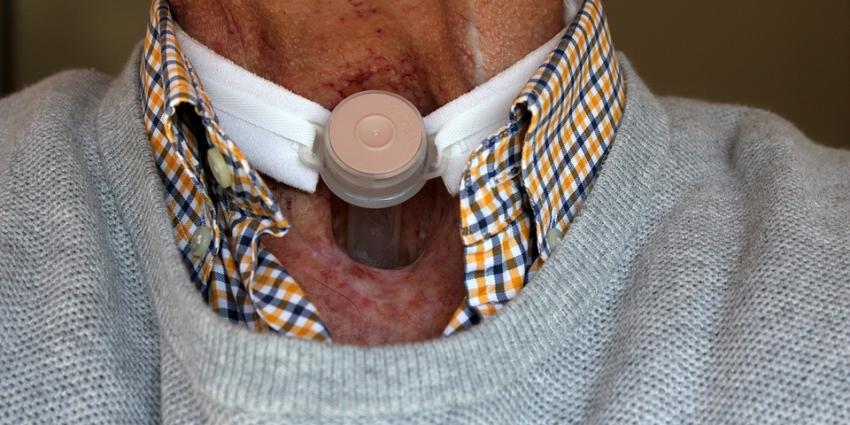 Veel kankerpatiënten in ongewisse over gevolgen behandeling Veel kankerpatiënten in ongewisse over gevolgen behandeling