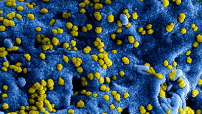 Coronavirus Coronavirus